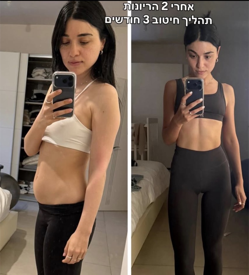 לפני ואחרי